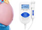 Sonoline B CE FDA ก่อนคลอด Doppler ทารกในครรภ์ 3Mhz Probe ไฟหน้าแรกใช้ Pocket Heart Rate Monitor ผู้ผลิต
