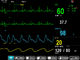 E12 Multi Parameter Oscillometry Modular Patient Monitor , 12 Inch TFT Display ผู้ผลิต