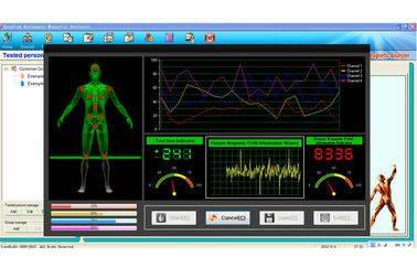 มินิควอนตัม Bio-Electric วิเคราะห์สุขภาพทั้ง Resonance Magnetic ผู้ผลิต